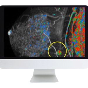 Breast Imaging Pearls and Pitfalls: Traditional and Novel Imaging Approaches 2020 (Videos)