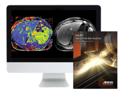 Body MRI: How to Provide Value-Based Care 2018 (ARRS VIDEOS) (Videos)
