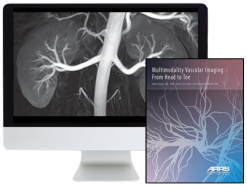 Multimodality Vascular Imaging: From Head to Toe 2020 (Videos)