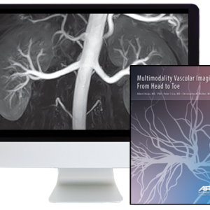 Multimodality Vascular Imaging: From Head to Toe 2020 (Videos)