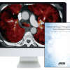 Practical Dual-Energy CT Throughout the Body 2021 (Videos)