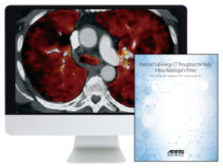 Practical Dual-Energy CT Throughout the Body 2021 (Videos)