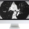 ARRS Basic Chest Imaging 2019 (Videos)