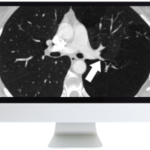 ARRS Basic Chest Imaging 2019 (Videos)