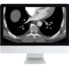 Clinical Cardiopulmonary Imaging Review 2019 (ARRS VIDEOS) (Videos)