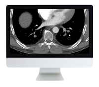 Clinical Cardiopulmonary Imaging Review 2019 (ARRS VIDEOS) (Videos)