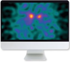 Clinical Case-Based Review of Nuclear Medicine 2019 (Videos)