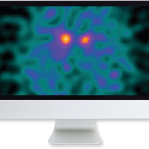Clinical Case-Based Review of Nuclear Medicine 2019 (Videos)