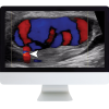Clinical Ultrasound Review 2017 (ARRS VIDEOS) (Videos)