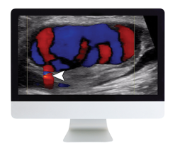 Clinical Ultrasound Review 2017 (ARRS VIDEOS) (Videos)
