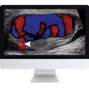 Clinical Ultrasound Review 2017 (ARRS VIDEOS) (Videos)