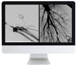 ARRS Case Review of Vascular and Interventional Radiology 2023 (Videos)