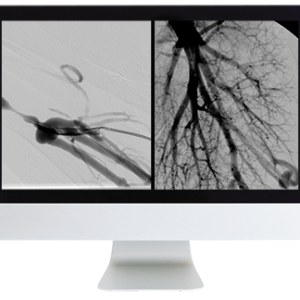 ARRS Case Review of Vascular and Interventional Radiology 2023 (Videos)