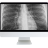 ARRS Case-Based Imaging Review Online Course 2022 (Videos)