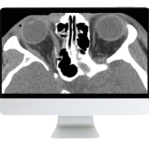 Imaging Victims of Violence Fists, Stabs, Bullets, and Blasts 2021 (Videos)