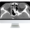 ARRS Imaging Victims of Violence: Fists, Stabs, Bullets, and Blasts 2021 (Videos)