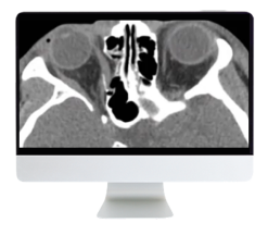 ARRS Imaging Victims of Violence: Fists, Stabs, Bullets, and Blasts 2021 (Videos)