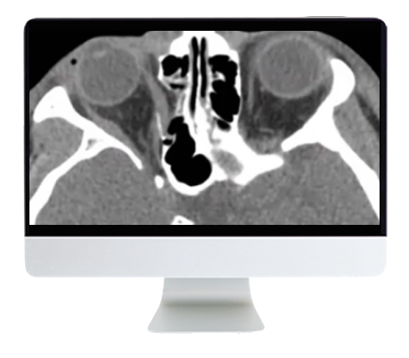 ARRS Imaging Victims of Violence: Fists, Stabs, Bullets, and Blasts 2021 (Videos)