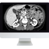 ARRS Gastrointestinal Imaging Online Course 2019 (Videos)