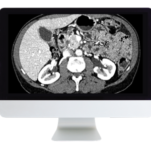 ARRS Gastrointestinal Imaging Online Course 2019 (Videos)