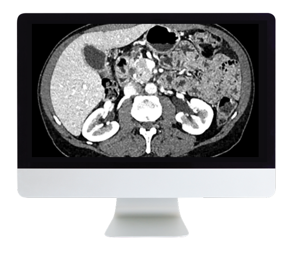 ARRS Gastrointestinal Imaging Online Course 2019 (Videos)