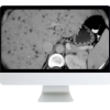 ARRS State of the Art Liver Imaging in Cirrhosis 2021 (Videos)