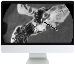 Deep Dive into Head and Neck Radiology 2020 (Videos)