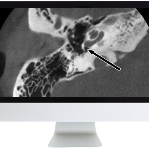 Deep Dive into Head and Neck Radiology 2020 (Videos)