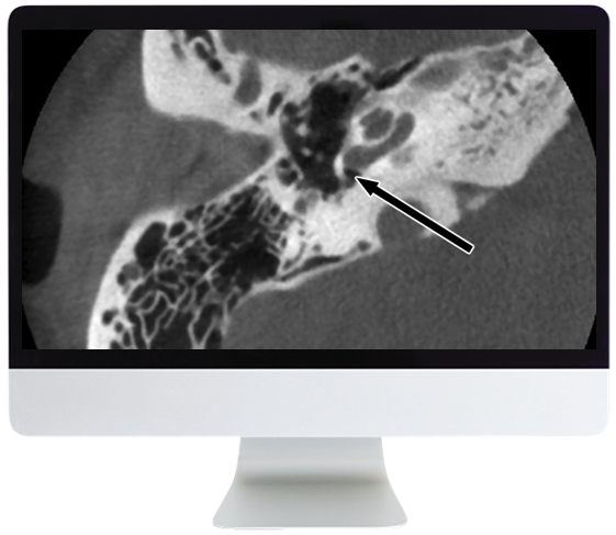 Deep Dive into Head and Neck Radiology 2020 (Videos)
