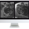 ARRS Controversies in Hip and Pelvis Imaging 2016 (Videos)