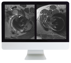 ARRS Controversies in Hip and Pelvis Imaging 2016 (Videos)