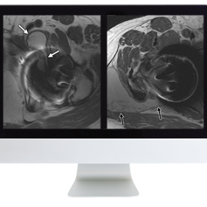 ARRS Controversies in Hip and Pelvis Imaging 2016 (Videos)