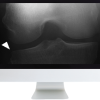 Musculoskeletal Imaging for the Practicing Radiologist 2018 (ARRS VIDEOS) (Videos)