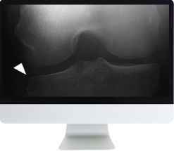 Musculoskeletal Imaging for the Practicing Radiologist 2018 (ARRS VIDEOS) (Videos)