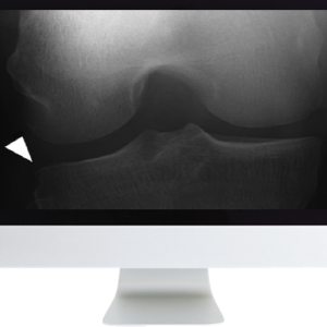 Musculoskeletal Imaging for the Practicing Radiologist 2018 (ARRS VIDEOS) (Videos)