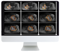 ARRS Crossroads of Computational Science and Musculoskeletal Imaging: Where Machine Magic Can Aid Radiologists 2021 (Videos)