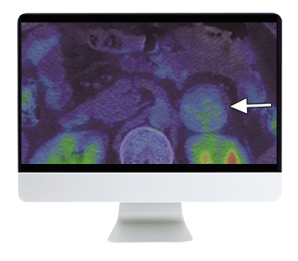 Breakthroughs in Nuclear Medicine for Neurology and Oncology 2021 (Videos)