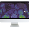 ARRS Breakthroughs in Nuclear Medicine for Neurology and Oncology 2021 (Videos)