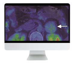 ARRS Breakthroughs in Nuclear Medicine for Neurology and Oncology 2021 (Videos)
