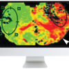 Code Stroke: What the Radiologist Needs to Know in the Changing Landscape of Acute Ischemic Stroke 2019 (Videos)