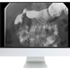 ARRS Practical Pediatric Imaging 2021 (Videos)