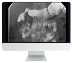 ARRS Practical Pediatric Imaging 2021 (Videos)