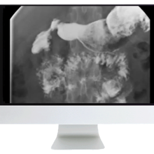 ARRS Practical Pediatric Imaging 2021 (Videos)