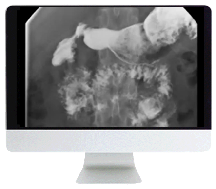 ARRS Practical Pediatric Imaging 2021 (Videos)