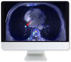 Applying Recent Advances in PET to Clinical Practice 2020 (Videos)