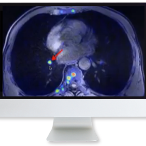 Applying Recent Advances in PET to Clinical Practice 2020 (Videos)