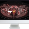 Molecular Imaging and Therapy of Prostate Cancer 2020 (Videos)