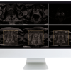 ARRS Pearls and Pitfalls in Prostate and Pelvic Imaging 2021 (Videos)