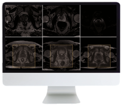 ARRS Pearls and Pitfalls in Prostate and Pelvic Imaging 2021 (Videos)