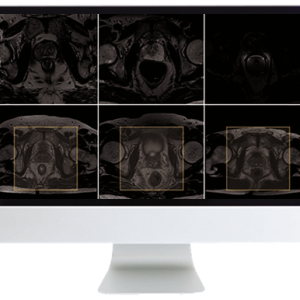 ARRS Pearls and Pitfalls in Prostate and Pelvic Imaging 2021 (Videos)
